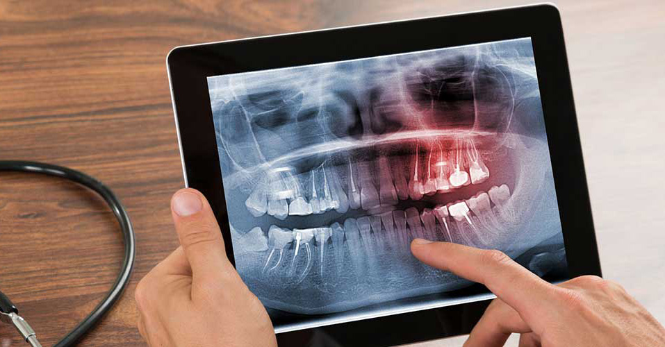 Jaw and teeth x-ray for surgical orthodontics