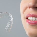 Is the risk of at home dental braces worth it?
