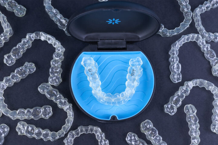 4 Invisalign mistakes that many people make